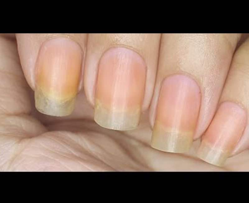 why-are-nails-yellow-after-removing-polish-at-clarence-amato-blog