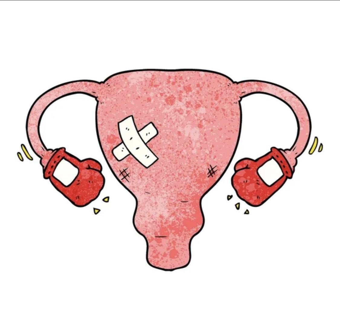 How Endometriosis can be treated?