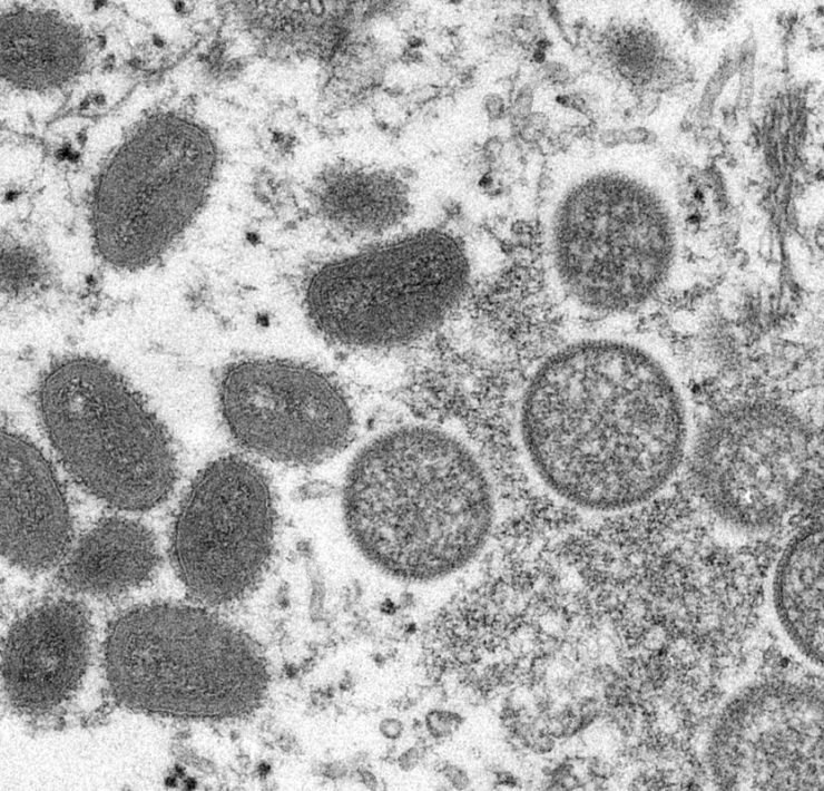 Monkeypox | All You Need To Know About The Emerging Virus!