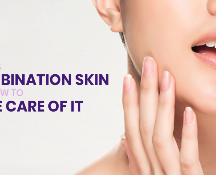 What is combination skin