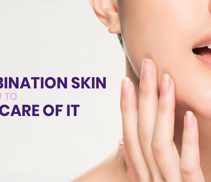 What is combination skin