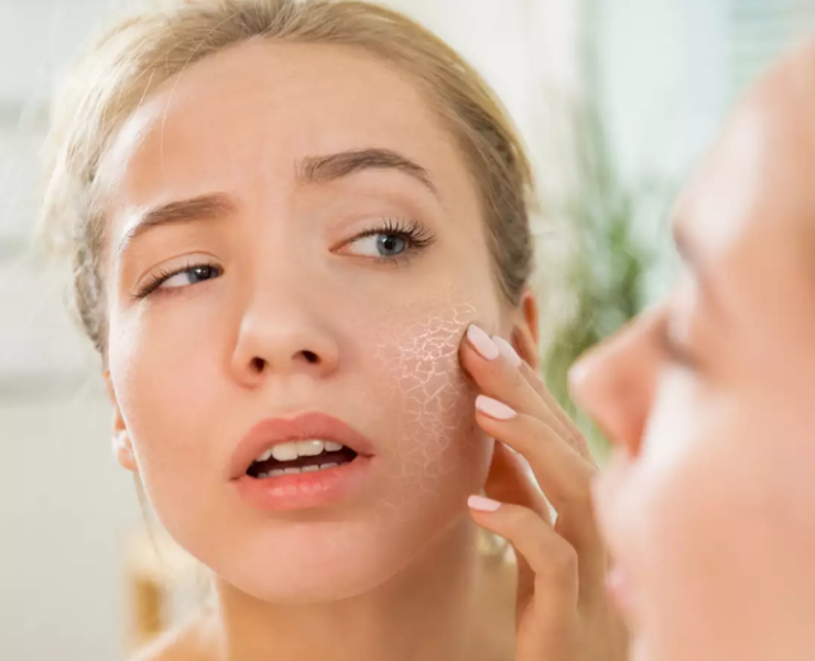 Fighting The Dry Skin Dilemma