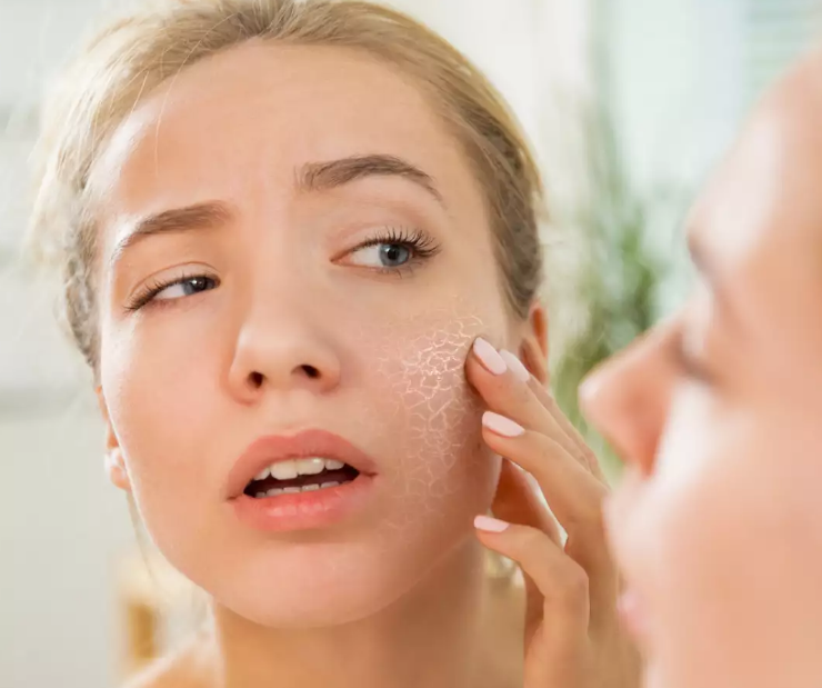 Fighting The Dry Skin Dilemma