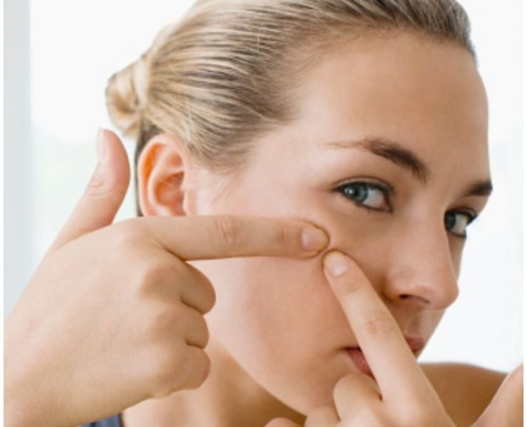 How To Get Rid Of Blackheads At Home