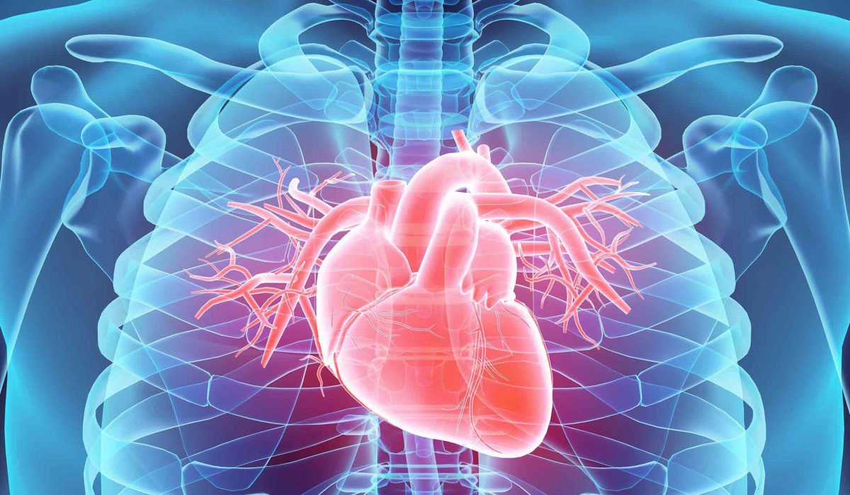 stroke or heart attack