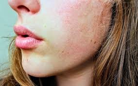 Messes With Your Skin