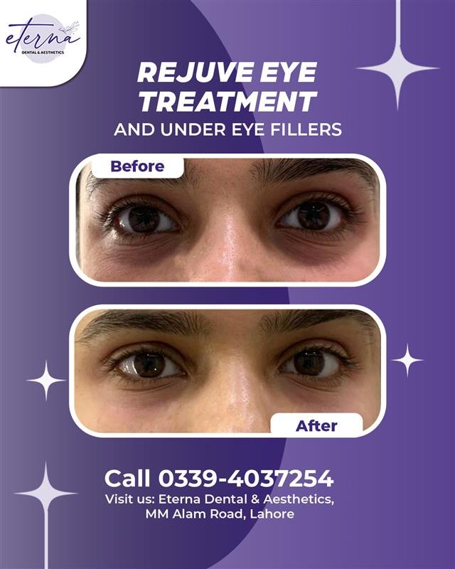 Eye Area Rejuvenation